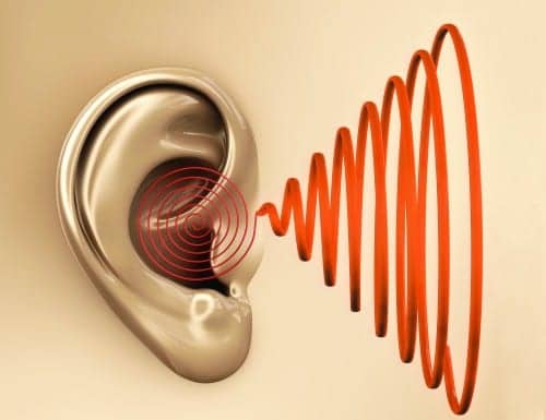 What Does Tinnitus Sound Like?